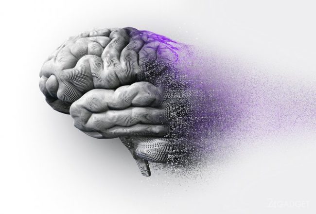Разделение болезни Альцгеймера на 6 видов повысит эффективность её лечения (3 фото)