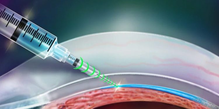 Уколов можно не бояться — создана «умная» игла для аккуратных инъекций