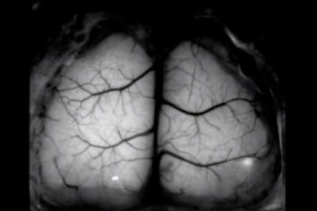 Ученые создали прозрачный имплантат для изучения живого мозга в реальном времени