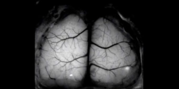 Ученые создали прозрачный имплантат для изучения живого мозга в реальном времени