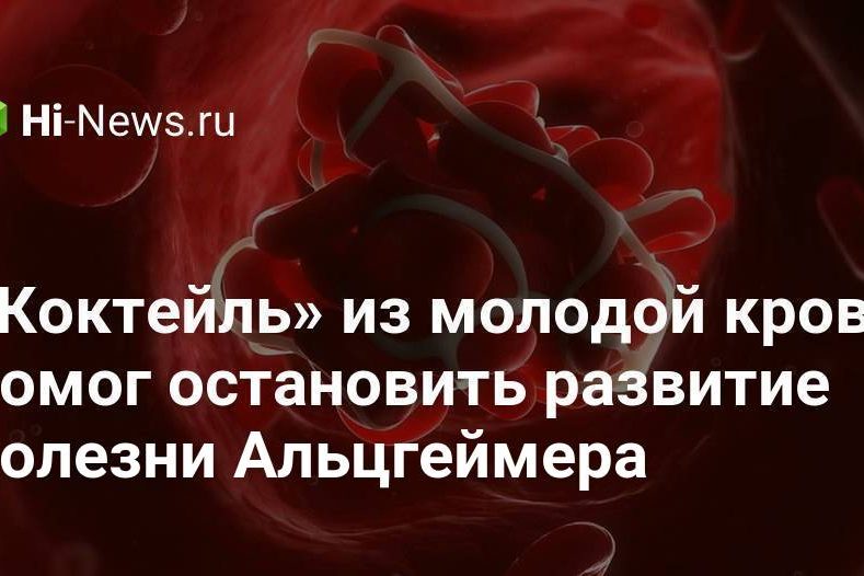 «Коктейль» из молодой крови помог остановить развитие болезни Альцгеймера