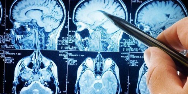 Заснят процесс «промывки» головного мозга спинномозговой жидкостью » 24Gadget.Ru :: Гаджеты и технологии