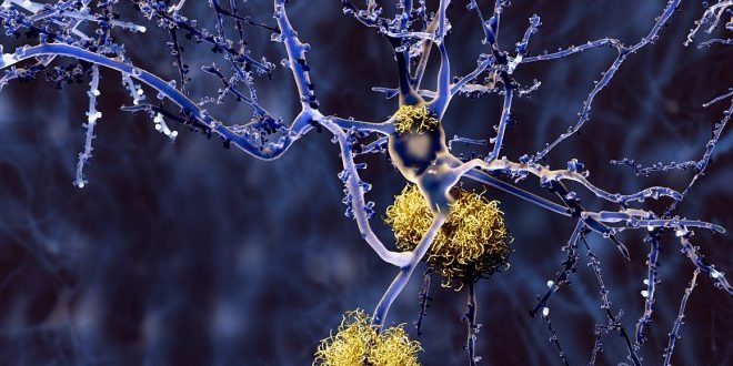 Естественная пульсация сосудов мозга может привести к предотвращению болезни Альцгеймера (2 фото) » 24Gadget.Ru :: Гаджеты и технологии