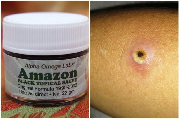 <pre>Facebook запретил группы, которые пропагандируют фальшивое лекарство от рака