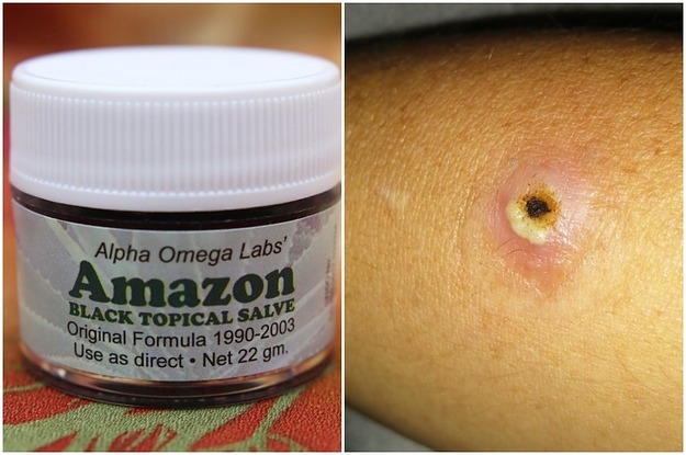 <pre>Facebook запретил группы, которые пропагандируют фальшивое лекарство от рака