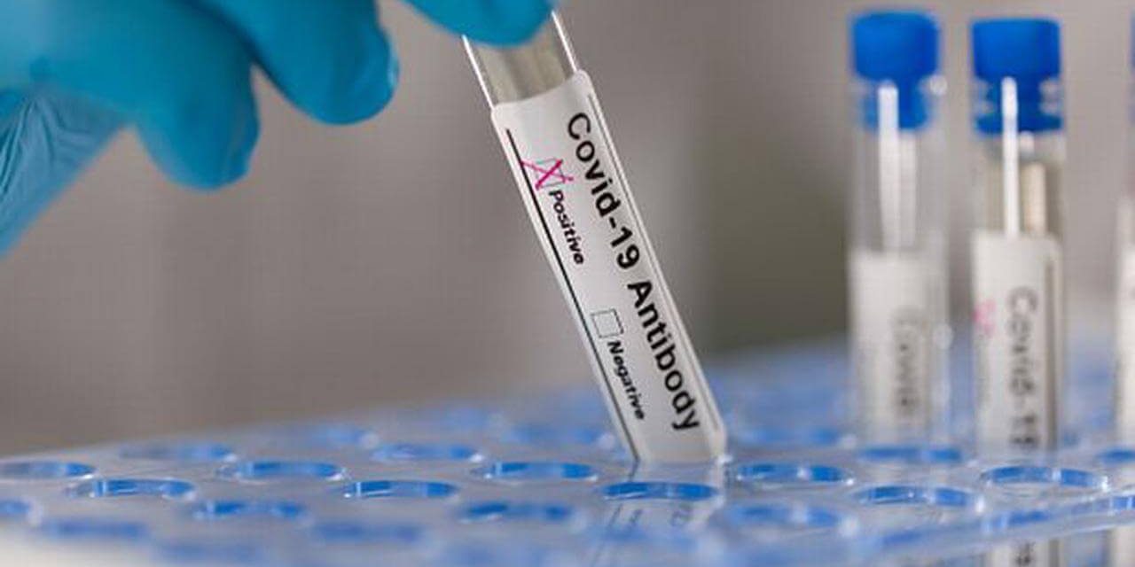 Чем отличаются антитела к коронавирусу и какой тест сдавать