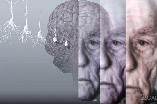 Россияне приблизились к излечению болезней Альцгеймера и Паркинсона » 24Gadget.Ru :: Гаджеты и технологии