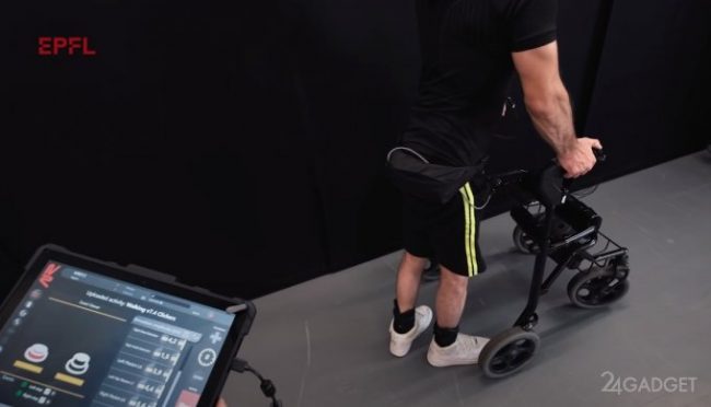 Спиномозговой имплант поставил парализованных пациентов на ноги (видео) » 24Gadget.Ru :: Гаджеты и технологии