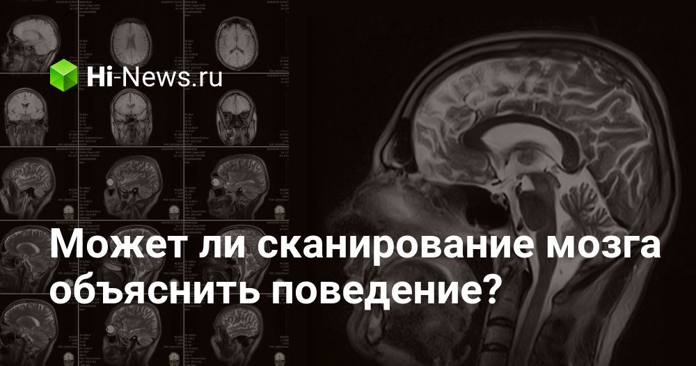 Может ли сканирование мозга объяснить поведение человека?
