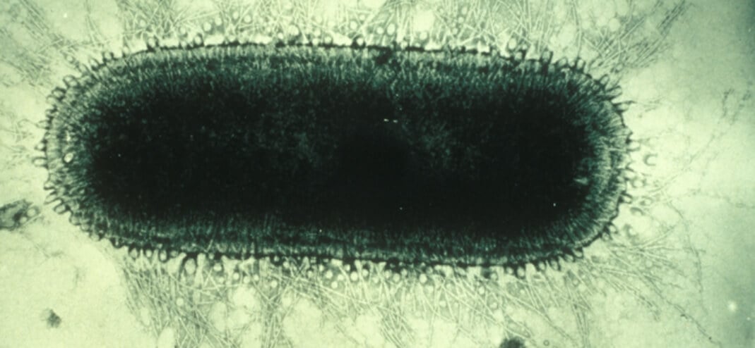Вирусы-паразиты, влияющие на разум. Вирус бешенства под электронным микроскопом. Фото.