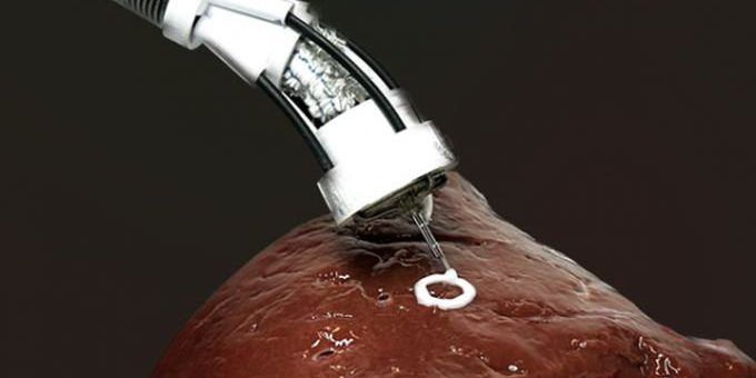 Учёные создали робота, способного печатать клетки на органах внутри тела