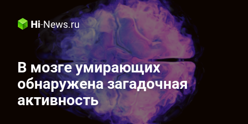 В мозге умирающих обнаружена загадочная активность