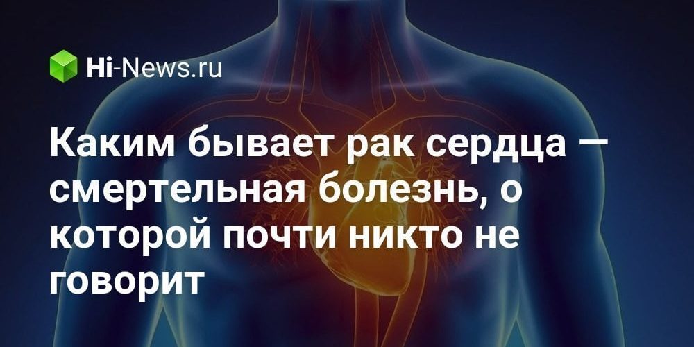 Каким бывает рак сердца — смертельная болезнь, о которой почти
