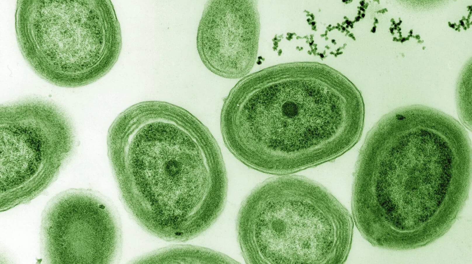 Кто производит больше кислорода. Бактерии Prochlorococcus под микроскопом. Источник изображения: numerama.com. Фото.