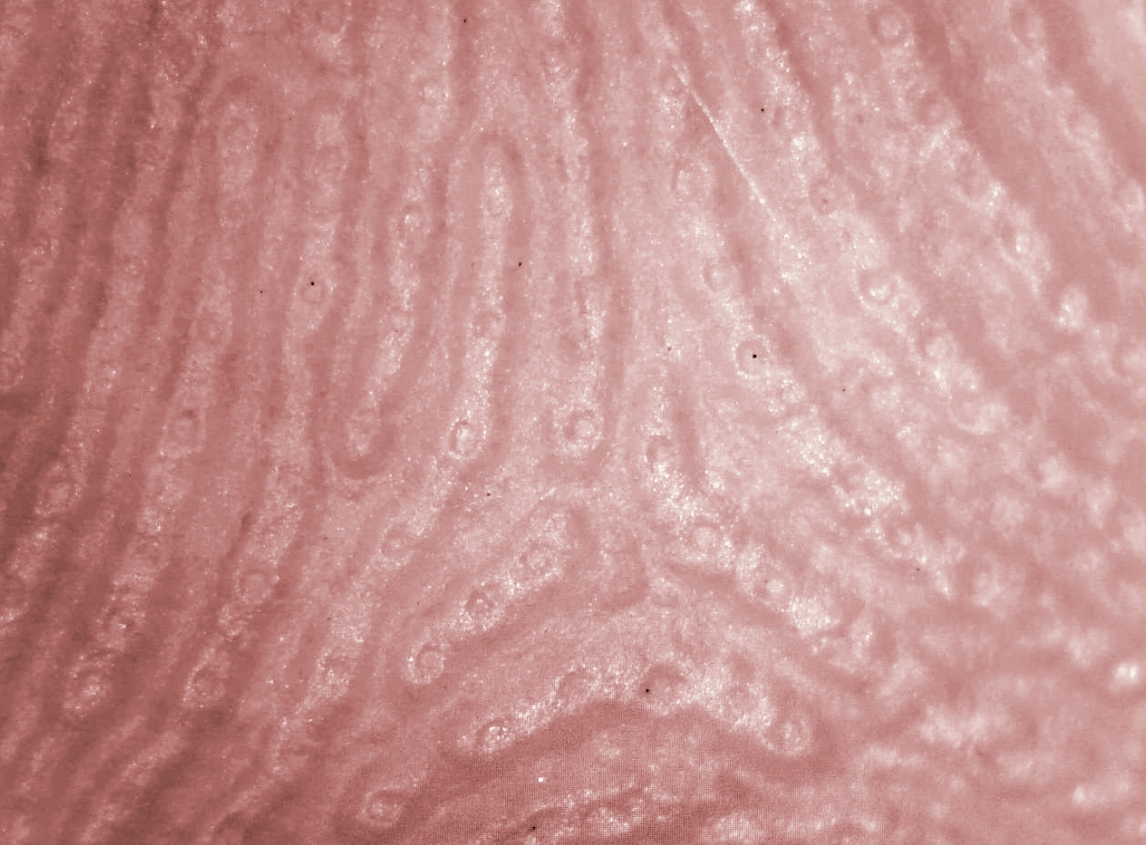 Почему воняют подмышки. Поры потовых желез на подушечке пальца человека. Источник изображения: wikimedia.org. Фото.